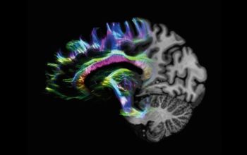 hc-fr-cs-irm-expert-neurologie-1-06235230_8